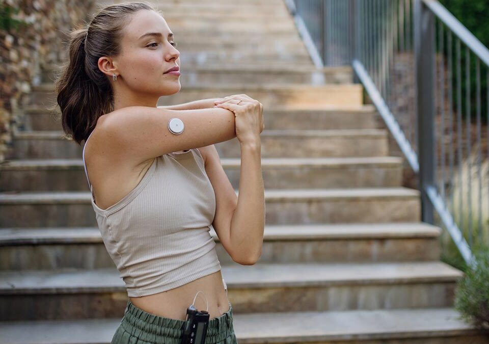 Mulher com diabetes jovem que se prepara para correr ao ar livre na cidade